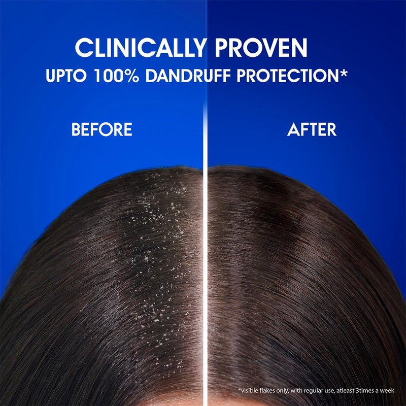 Head & Shoulders Anti-Dandruff Shampoo (Cool Menthol and Energizes Scalp) - 1L