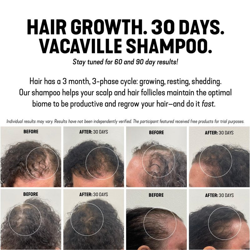 Vacaville Beauty Powder Shampoo for Hair Growth, Orange Scented | Waterless, Eco Friendly & Travel Shampoo | Natural Vegan Formula for Thinning Hair & Sensitive Scalp | Full Size