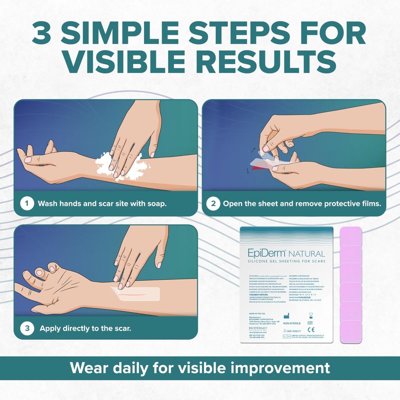 Epi-Derm Epi-Tab Squares Silicone Scar Sheets – Professional-Grade, Washable & Reusable Silicone Patches for Small Hypertrophic & Keloid Scars from Trauma, Liposuction & More - Clear, 6-Pack
