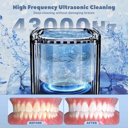 Ultrasonic Dental Cleaner;UltraSonic Retainer Cleaner Machine for Denture,Aligner,Earring,whitening tray,200ml Portable Mouth Guard Cleaner,Invisalign cleaner,Professional Sonic Jewelry cleaner black