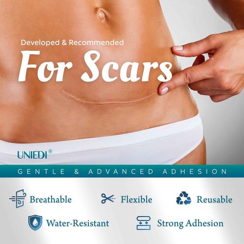 Silicone Scar Sheets, Silicone Scar Tape(1.6"x 120" Roll - 3 Meters) Scar Tape for Surgical Scars, Silicone Tape for Scars, Silicone Scar Strips for C-Section, Tummy Tuck, Keloid, and Surgical Scars