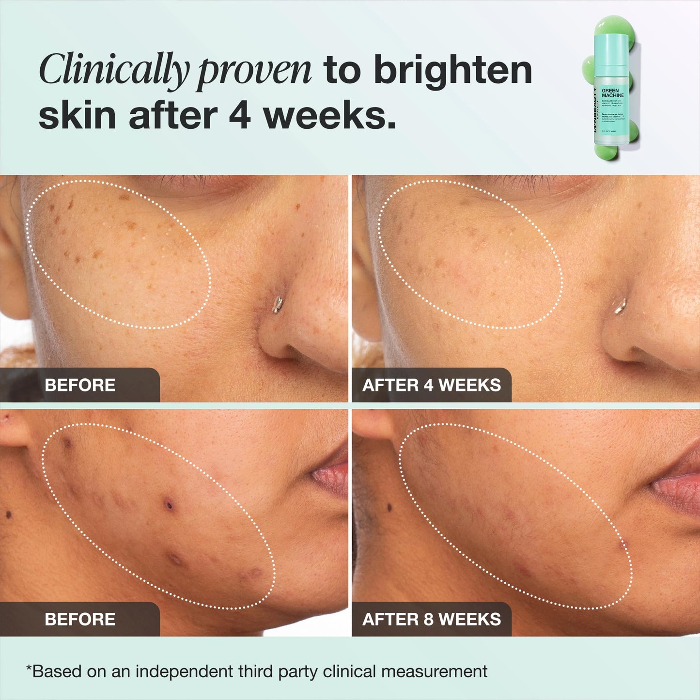 INNBEAUTY PROJECT Green Machine Vitamin C Dark Spot & Hyperpigmentation Serum, REFILL, 1 FL OZ (30ml)