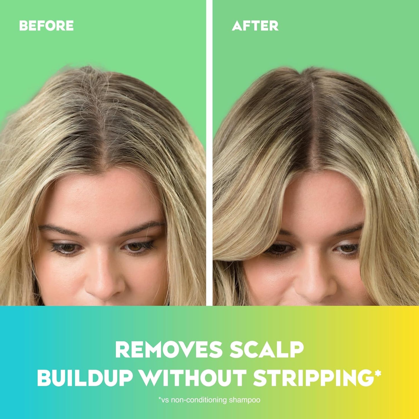 OGX Extra Strength Refreshing Scalp + Rosemary Mint Conditioner, Nourishing Hair & Scalp Conditioner Infused with Rosemary for Healthy-Looking Hair, Sulfate-Free Surfactants, 13 fl. oz
