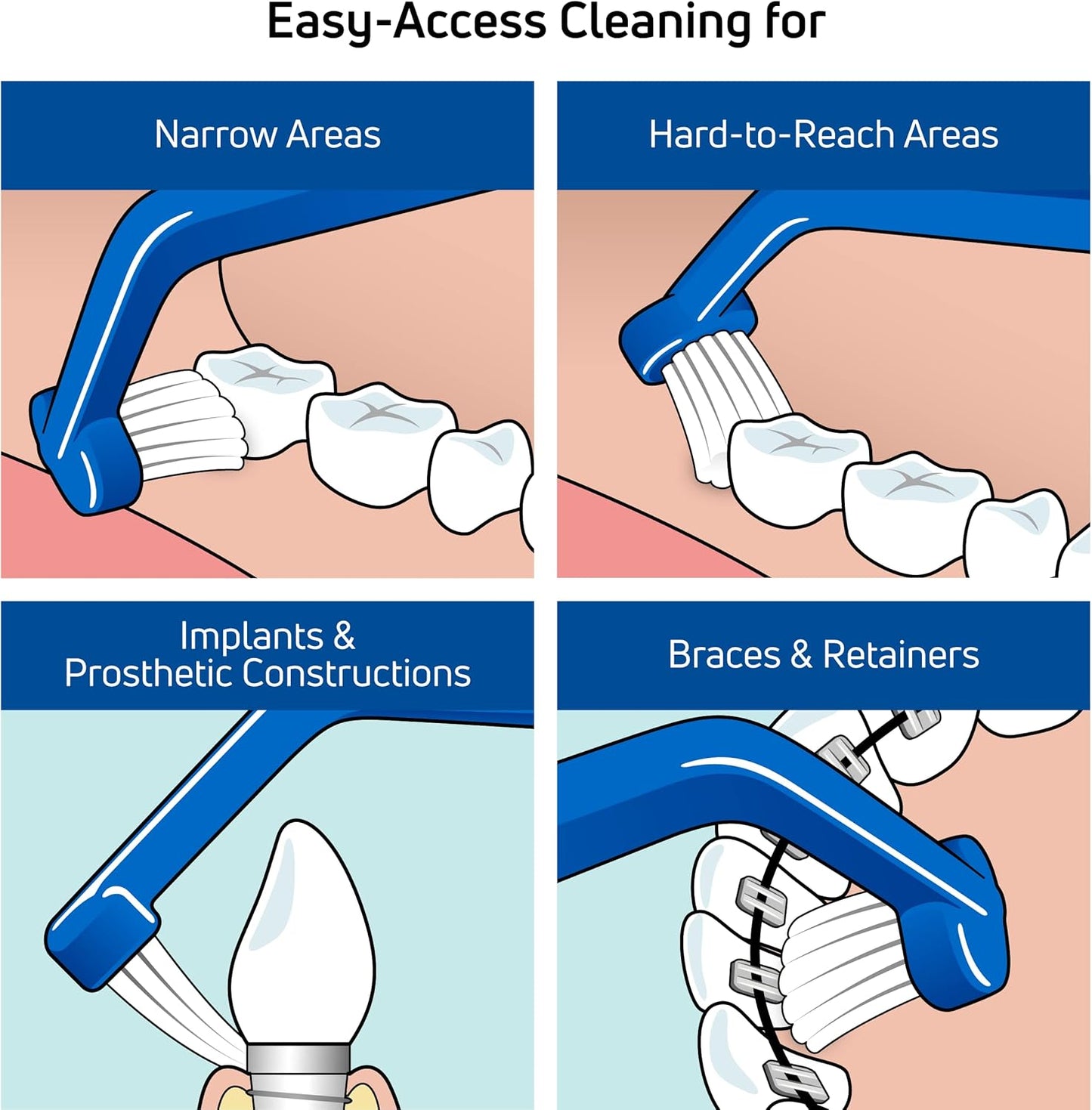 TePe Universal Care Angled Soft-Bristle Toothbrush, Small-Head Orthodontic Toothbrush