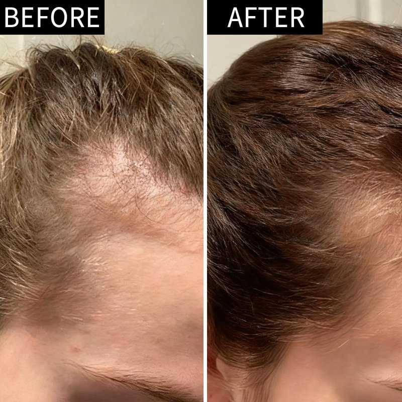 SYEYYDS Hair Growth Serum with Biotin & Ginseng - Hair Loss Treatment for Men & Women, Scalp Care Solution for Thinning Hair, Plant-Based Formula for Fuller Looking Hair