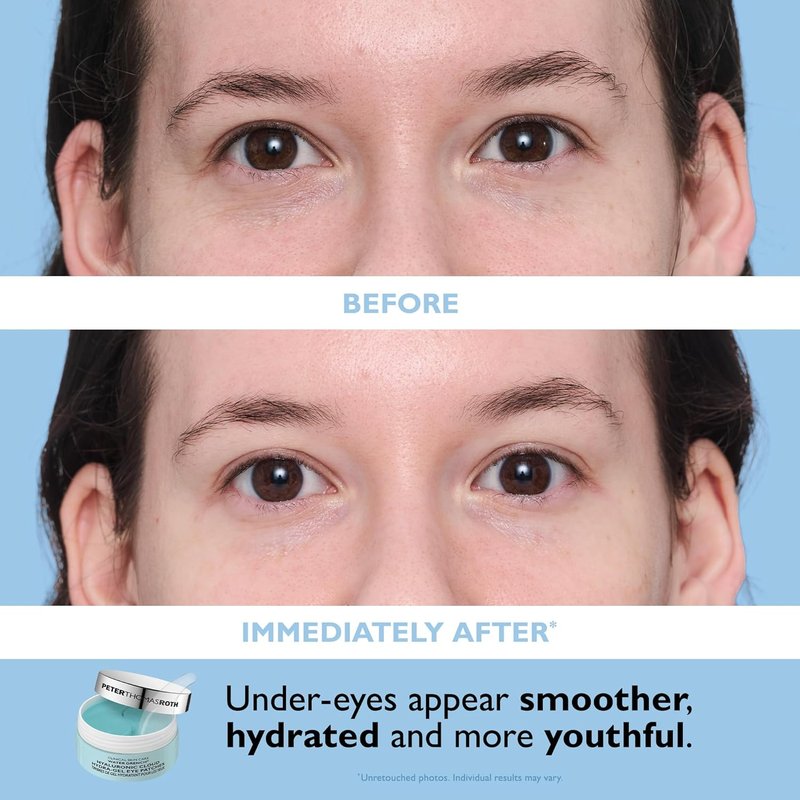 Peter Thomas Roth | Water Drench® Face & Eye Skincare Set - Hyaluronic Acid Moisturizer & Eye Masks, Full Size