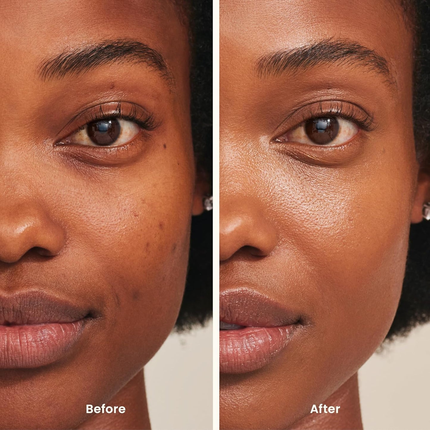 Perfect Complexion Concealer - Cream for Medium Skin with Neutral Undertones | 1 oz