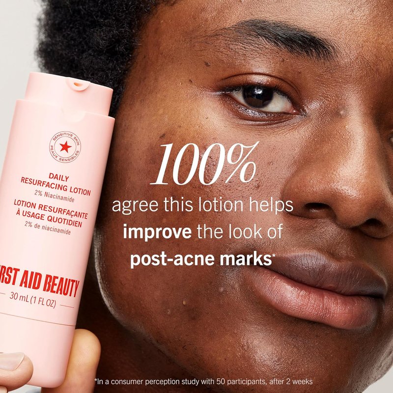 First Aid Beauty Acne Treatment Bundle | Pads, Lotion & Mist for Clear Skin