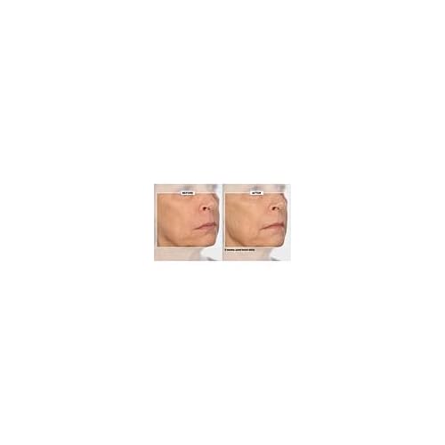 Signature Club A 5 Essentials Creme for Face and Eyes with Plant Stem Cell Complex
