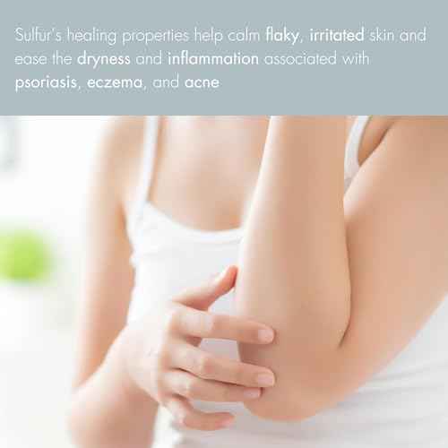 Jericho Dead Sea Sulfur Soap with Olive Oil – Helps with Acne, Psoriasis, Eczema & Blackheads – For Oily to Normal Skin – Vegan Face & Body Bar for Men & Women, 4.4 Oz / 125 g (Pack of 6)