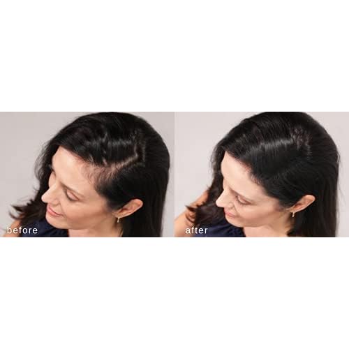 LUXE Hair Building Fibers - Thickening Fibers - CONFIDENCE IN A JAR ? 2 Months+ Supply! ? Hypoallergenic, Dermatologist Tested ? Multiple Colors Available (Dark Brown)