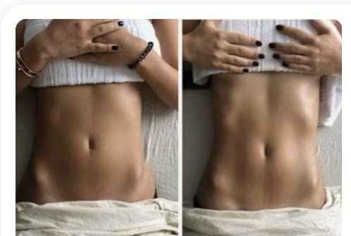 Lymphatic Drainage Paddle Wood & Dry Skin Brush Set - Anti-Cellulite Tools for a Healthier Lymphatic System With Body Brush