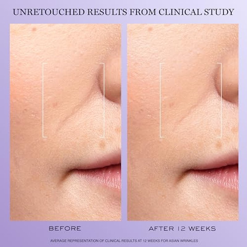 Lanc?me R?nergie H.C.F. Triple Serum - Hyaluronic Acid Serum for Visible Correction of Anti Aging Signs & Dark Spots - With Vitamin C+, Niacinamide & Ferulic Acid