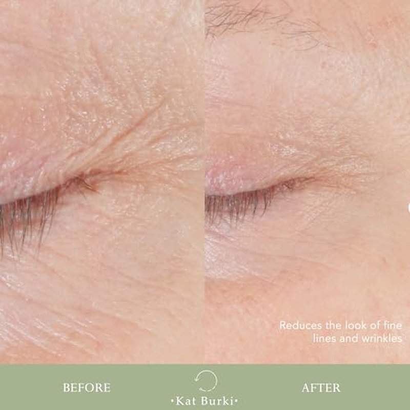 Kat Burki Form Control Marine Collagen Face Serum. Clinically Proven Anti-Aging Care Promoting Collagen Production: Lifts, Plumps & Contours Skin