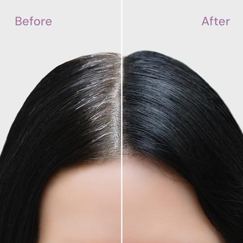 Style Edit Root Concealer Touch Up Spray (Multiple Colors Available) - Instantly Covers Greys And Roots - Professional Salon Quality Grays Cover Up Hair Products for Women Medium Brown 2 Ounce PACK OF 4 PLUS 1 FREE (Total Of 5)