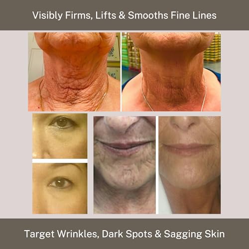 InfiniteAloe r?parneu Gold Anti-Aging Formula, Neck Firming, Face Tightening, Anti Wrinkle Face Cream - Organic Aloe Powered with Collagen, Peptides & Retinyl - 0.5oz Jar