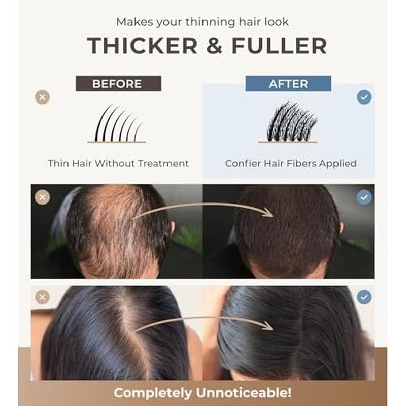 Keratin Hair Fibers for Men & Women - Fill In Fine or Thinning Hair, Instantly Thicker, Fuller Looking Hair (Dark Brown 15g)