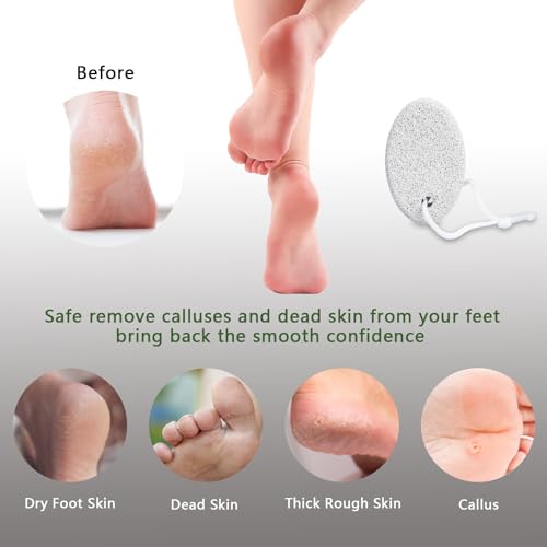 Natural Foot Pumice Stone for Feet, Borogo 2-Pack Lava Pedicure Tools Hard Skin Callus Remover for Feet and Hands - White&Red
