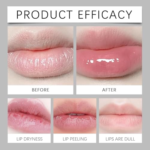 Belani Fordyce Lip Cream, Hydrating Lip Treatment with Nourishing Formula, Long-Lasting Moisture Care for Dry Lips, Gentle Exfoliation to Reduce Dryness and Smooth Dead Skin (1)