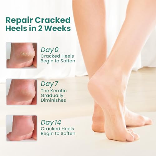 Welnove Moisturizing Heel Socks - 2 Pairs Aloe Vera Extract Infused Gel Lining for Dry Feet - Cracked Heel Repair Treatment - Cotton Socks for Women Men Foot Care (Regular Sizes)