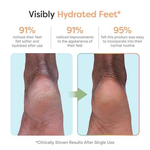 ZenToes Moisturizing Foot Mask for Dry Cracked Feet | Shea Butter, Jojoba Oil & Squalane Infused Hydrating Sheet Masks | Spa Experience At Home | Mess Free Design | Vanilla Citrus Scented, 3 Pairs