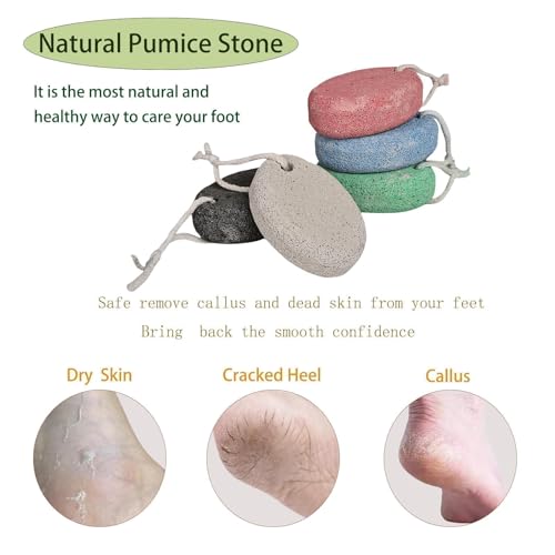 2PCS Natural Foot Pumice Stone£¬Natural Lava Pumice Stone for Feet, Foot Scrubber£¬Effective Pedicure Tools for Dead Skin and Callus Removal (Grey)