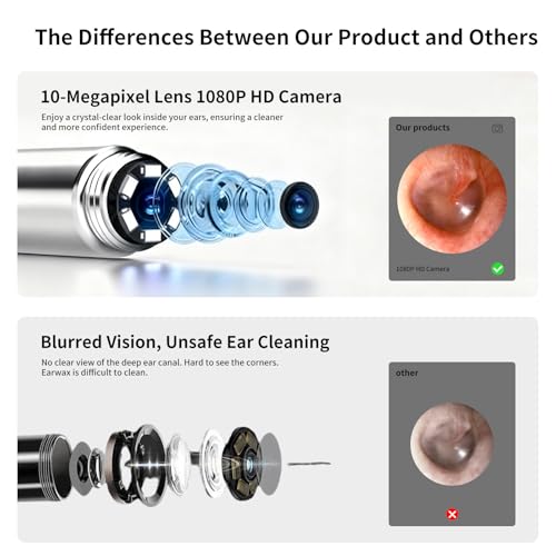 Sofbunny A03 Ear Wax Removal Tool Camera, Ear Cleaner with 1080P HD Camera, 3 in 1 Ear Cleaning Tool with 10 Replacement Tips,Earwax Remover Kit for Kids & Adults,Otoscope with LED Lights,256MB Card