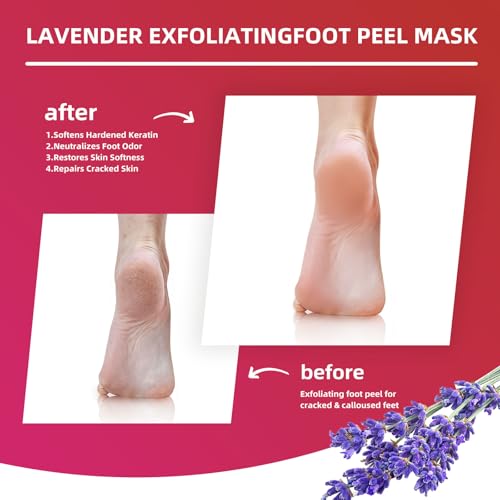 Foot Peel Mask for Dry, Rough Feet ? Exfoliating Foot Mask with Fruit Acids, Lavender & Urea ? Peeling Socks for Dead Skin & Cracked Heels ? Foot Care for Women & Men