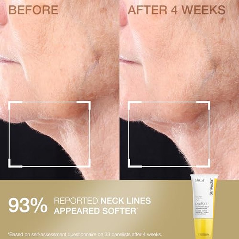 StriVectin Tighten and Lift Advanced Neck Cream PLUS with Alpha-3 Peptides for Neck and D?collet?, Smoothing Look of Wrinkles and Fine Lines, Improves Crepey Skin and Vertical Lines