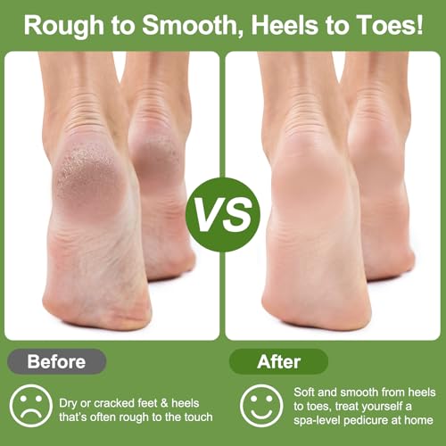 Pumice Stone for Feet, 3 Pack Natural Earth Lava Foot Callus Remover & Pedicure Exfoliator Tools for Heels, Soles and Toe Gaps, Foot Scrubber for Dry & Dead Skin