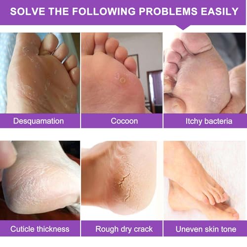 Foot Peeling Mask 5 Pack, Moisturizing Socks for Dry Foot Care, Hydrating Feet Peel Masks Repair Dry Cracked Heels, Remove Dead Skin,Callus - Women Men (Lavender)