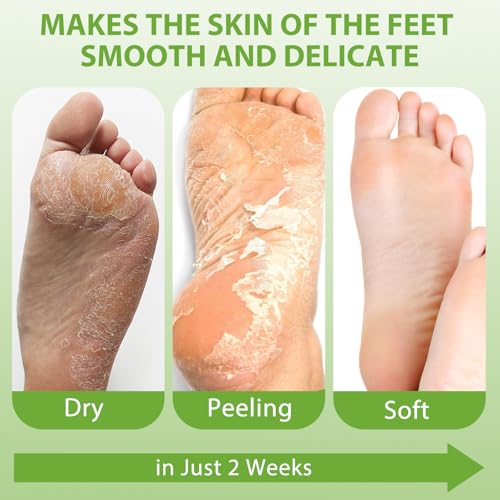 4 Pack Foot Peel Mask, Aloe Vera Hydrating Foot Mask, Deep Exfoliation for Smooth Feet, Foot Mask for Removes Dead Skin and Calluses, Nourishing Formula with Soothing Aloe