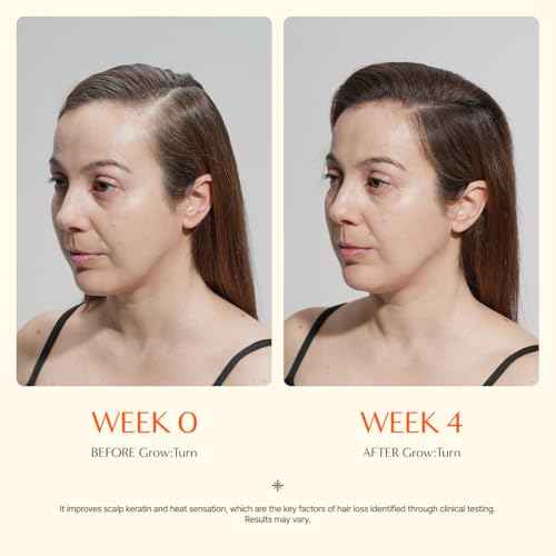 Growturn Hair Growth Serum with Built in Brush for Hair Growth & Thickening | Treatment for Thinning Hair, Hair Loss | Low Irritation, Fragrance-Free, Sulfate & Paraben-Free, 3.38 fl. oz. (Pack of 1)