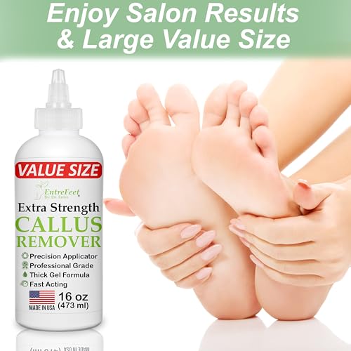 Dr. Entre's 16oz Callus Remover Gel: Extra Strength Value Size, Callus Remover for Feet, Pedicure Tools Supplies, Dead Skin Remover, Foot Care