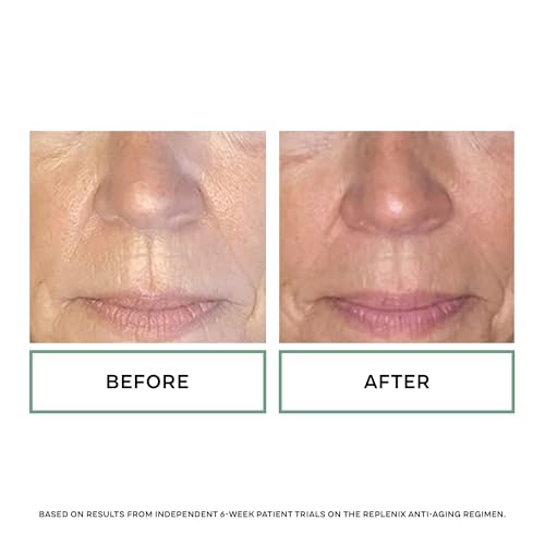 Replenix Age Restore Nighttime Therapy Face Cream, Anti-Aging Medical-Grade Facial Moisturizer for Mature & Dry Skin