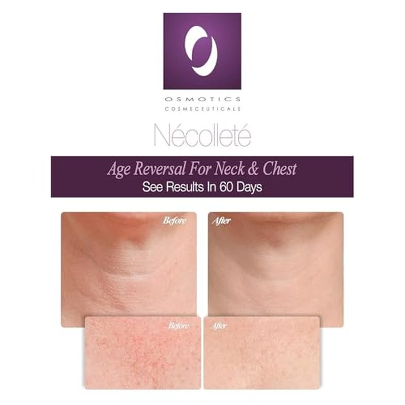 Osmotics N?collet? Age Reversal for Neck and Chest - Firms, Smooths & Tightens Fragile Skin on Neck, Chest & D?collet? | Anti-Aging Formula for Sun Damage - 1.7oz