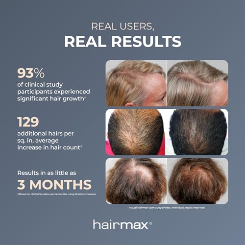 HairMax Laser Band 41 - (FDA Cleared) Hair Growth Device - Restores Natural Hair Cycle with Red Light Therapy