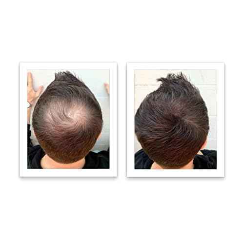 Caboki Hair Loss Concealer, 90-day supply, Dark Brown