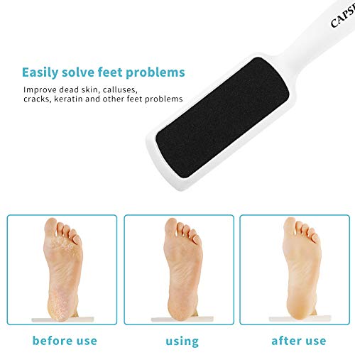 Pedicure Foot Rasp File Callus Remover, Double-Sided Colossal Foot Rasp Foot File And Callus Remover For Dead Skin (Pack of 4)