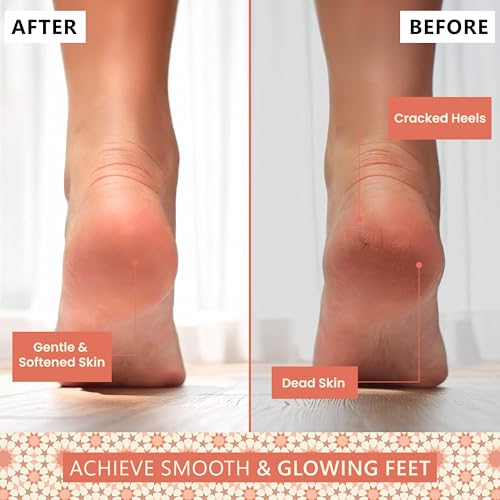 Natural Terracotta Pumice Stone for Feet ? Handcrafted Foot Scrubber & Callus Remover with Gentle Exfoliation and Ergonomic Design for Smooth, Soft & Refreshed Feet ? for a Spa-Like Pedicure