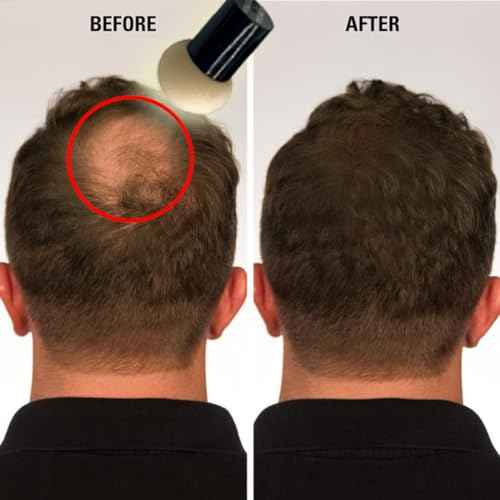 KERATIN RESEARCH Hairline Filler Unisex Mineral Powder Root Touch-Up Hair loss Concealer Scalp & Beard Bald Patch Coverage Fibers for Thinning Hair Waterproof Organic Natural look (DARK ASH BROWN, XL)