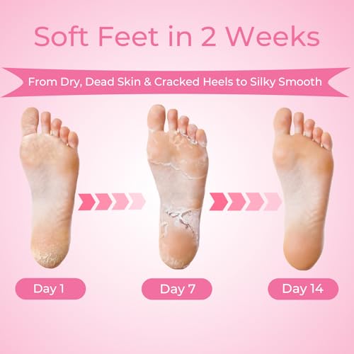 Foot Peeling Mask, 4 Pairs Foot Peel Mask for Dry Cracked Feet, Dead Skin Callus Removal, Repair Soft Feet
