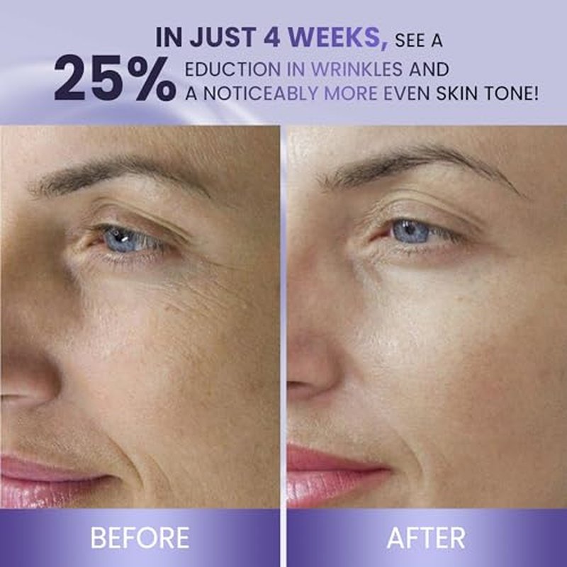 ABERA BELANI Retinol Night Cream For Women, Dark Spot Remover, Melasma Treatment, Reduce Fine Lines, Anti-Wrinkle, Anti-Aging Neck and D?collet? For Face (3 Box + Gift Eyelash Serum)