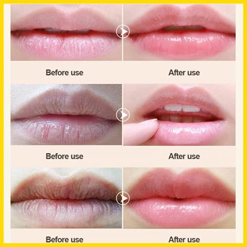 Doppeltree PLUMP IT Moisturizing Lip Mask (18 patches) - lip plumper, moisturizer for dry lips, chapped lip care and repair, conditioning lip exfoliator treatment - Formulated in San Francisco