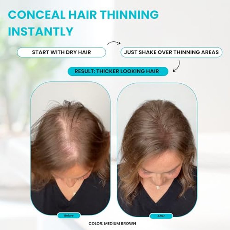 SURETHIK Hair Fibers, 30g (Dark Brown), Fills Thinning Hair for Visibly Fuller Look, Conceals Bald Spots, Natural Look, For Men & Women