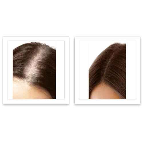 Caboki 10X Hair Powder for Thinning Hair, TALC-Free, Healthful Formula, Instantly Fuller Hair, Flawless Roots, Rain and Sweat Resistant, Easy to Use, Black, Unisex