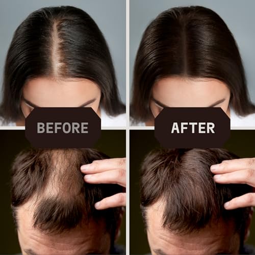 Striking Viking Hair Fibers - Dark Brown, 0.98 oz, Pack of 1 - Long-Lasting Hold & Hair Filler - Undetectable Coverage with Fiber Powder - Easy Application & Styling Powder