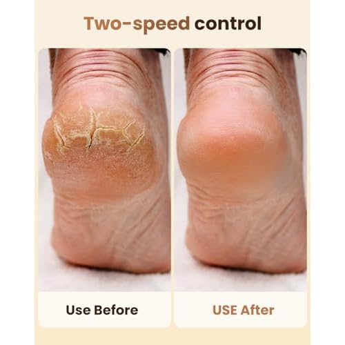 Electric Callus Remover for Feet - 2-Speed Rechargeable Pedicure Kit with 3 Rollers, IPX4 Waterproof Foot Scrubber & Digital Display | Professional Dead Skin & Callus Remover for Women/Men