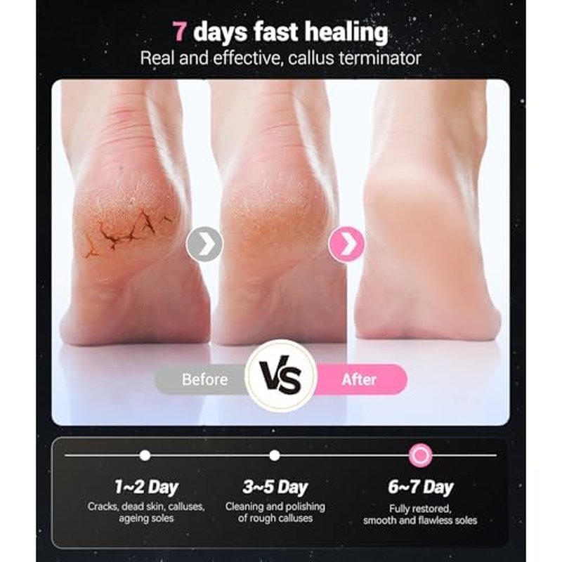 5-in-1 Professional Electric Callus Remover for Feet(Portable & Foldable), Removes 99.92% of Calluses in 3 Mins, Eectric Foot Callus Remover Pedicure Kits with 10 & 40 Grit Pads for Smooth Feet, Pink