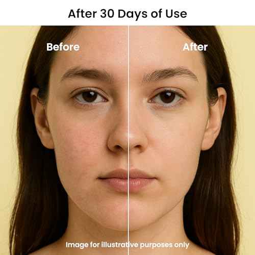 Feat By You ViTassie Pure Mountain Water First Care Toner - (5.41 FL OZ) Hydrating Toner for Face with Vitamin C & Hyaluronic Acid, Korean Skin Care Pore Minimizer Facial Toner, Vegan, Made in Korea